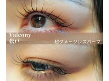 バルコニー(valcony)