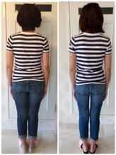 エイム(ame)/耳つぼ/痩身/ダイエット/豊田市