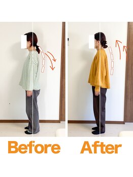 整体院ひなた 都城院/首肩こりストレートネック改善！