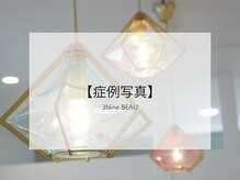 スリーナイン ビュウ(3Nine BEAU)/
