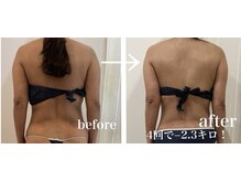 ドリームローズ(Dream Rose)/痩身