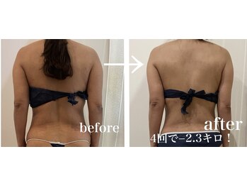 ドリームローズ(Dream Rose)/痩身