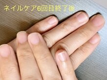 桃の木 吉祥寺店/ネイルケア6回目終了