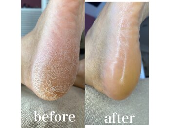 #けあなちゅらる