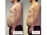 【メンズ痩身】WINBACK最上位機種で最速ダイエット☆肝臓・腎臓ケアで代謝UP!