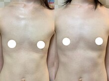 ハレオラ(HaleOla)/お客様の変化☆バストケア