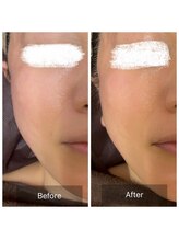 ラビ(RABBI)/50代女性　小顔矯正