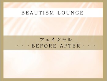 ビューティズムラウンジ(Beautism Lounge)/フェイシャル　ビフォーあふた