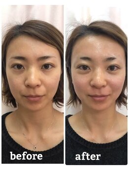 モガミヤ(MOGAMIYA)/20代女性 横須賀在住