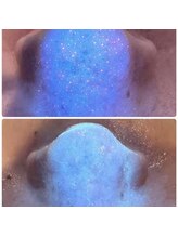 サロン ド ミコラ(salon de Micora)/【つまり毛穴】次世代毛穴洗浄！