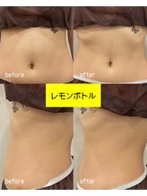 ヘルディン(heldin +555)