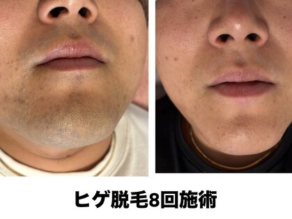 カモミール(Camomille)の写真