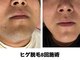 カモミール(Camomille)の写真