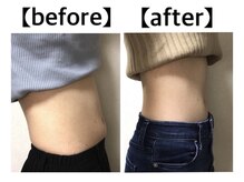 グロウ 南草津本店(GROW)/《リバウンドしないダイエット》