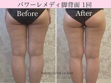 ラエッセ(La Esse)/下半身の悩みをなくしませんか？