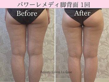 ラエッセ(La Esse)/下半身の悩みをなくしませんか?
