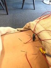 国分町鍼灸サロン/ボディ鍼灸 