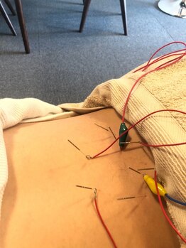 国分町鍼灸サロン/ボディ鍼灸 