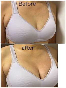 ベッピン(Beppin)/静岡バストケア/静岡育乳