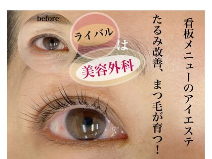 マージ イマージュの写真