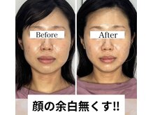 エミナル(EMINARU)の雰囲気（小顔矯正、お顔の痩身、脂肪を分解！ハーバルピール、毛穴洗浄、）