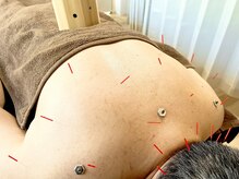 上楽スポーツ鍼灸院の雰囲気（【鍼灸施術】鍼灸×整体のメニューが当店大好評です◎）