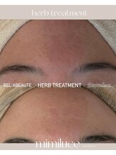 ミミルーチェ(mimiluce)/おでこのシワシミたるみにハーブ