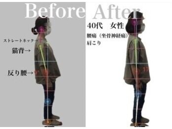 リスタート腰痛整体院 舟入院/症例3:40代女性　腰痛・肩こり