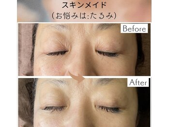 リラクゼーションサロン ラキ(laki)/スキンメイド/トロイアルケ