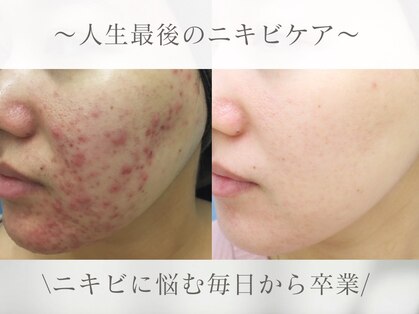 エピア 西尾店(Epia)の写真