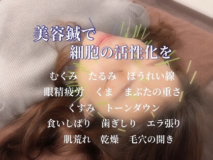 ベレディオ鍼灸整骨院(Belledio鍼灸整骨院)の写真