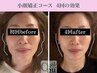 《再来女性の方》小顔頭蓋骨矯正＋リンパケア4回コース　￥30800→￥22800