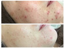 アンジュールの雰囲気（肌のメカニズムに基づいた本格的なフェイシャルエステを提供）