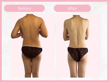 アールエイチビー 藤沢店(RHB)/