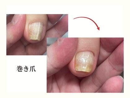 ミュウネイル 宜野湾(Myu nail)の写真