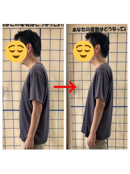 カイロプラクティック 楓/デスクワーク　ストレートネック