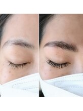 アマリリス(Amaryllis)/ハリウッドブロウリフト(HBL)