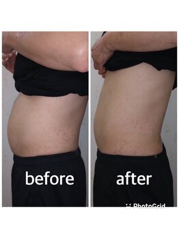 フェリーチェ ビューティー(Felice Beauty)/電磁パルス