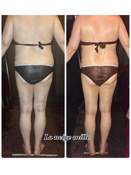 ラネージュミル(La neige mille)/インキュア痩身