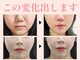 ゴールデンケア(goldencare)の写真