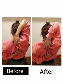 アース エンジェル整体院/ビフォアフ　肩甲骨ストレッチ