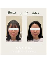 ククルヘルスビューティー(CUCURU health×beauty)/韓国肌管理最新美容で水光肌へ