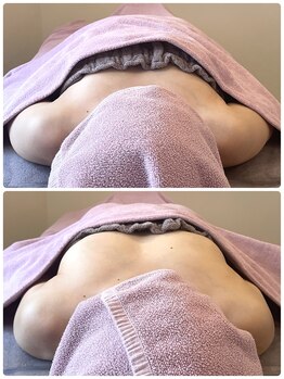 リンドール(RinDoll)/ダイエット/痩身/耳つぼ