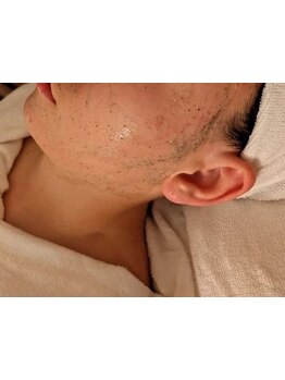 お肌をきれいにしたい