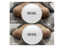 ベール(BEHL)/コルギのBefore After