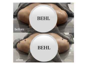 ベール(BEHL)/コルギのBefore After