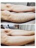 【春のBIGキャンペーン】新規の方必見！最新脱毛が初回半額！！！