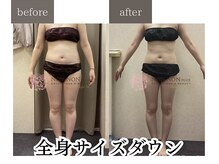 ノンノンプラス 博多(NON-NONプラス)/痩身結果