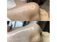 エイジングレスサロン ココロ 八女店(COCORO)