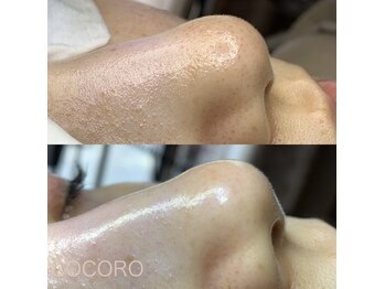 エイジングレスサロン ココロ 八女店(COCORO)